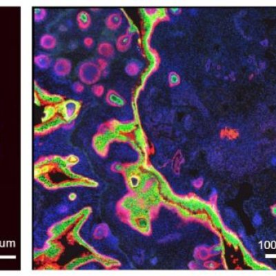 Two brightly coloured microscopic slides, side by side showing blobs and lines. 